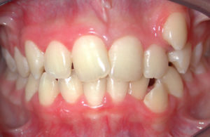 Orthodontiste Gonesse