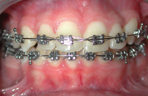 Orthodontiste Gonesse