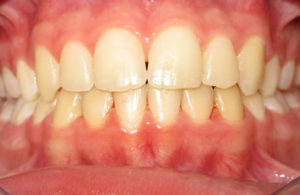Orthodontiste Gonesse