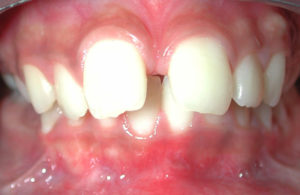 Orthodontiste Gonesse