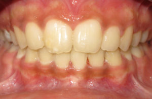 Orthodontiste Gonesse